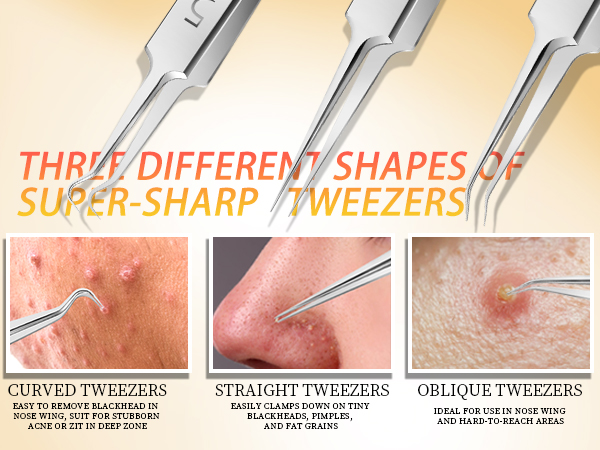 ingrown hair tweezers
