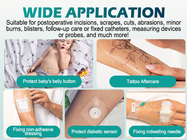 tegaderm transparent dressing