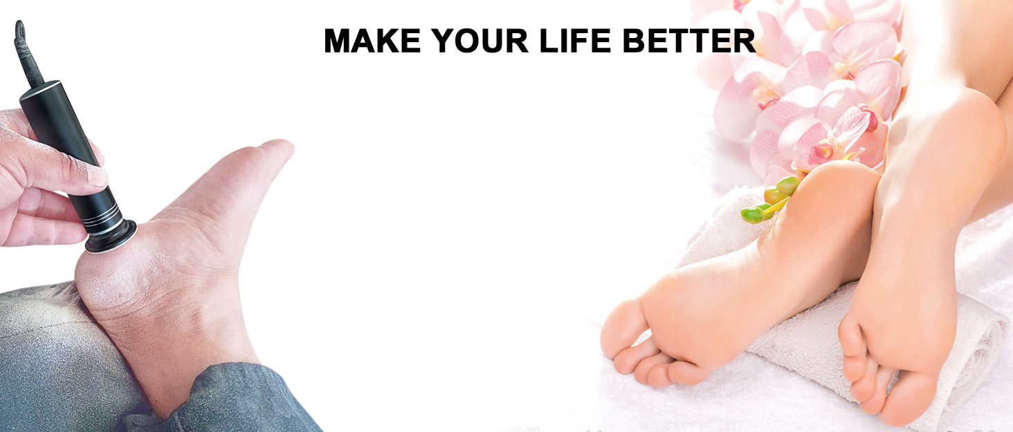 electric callus remover