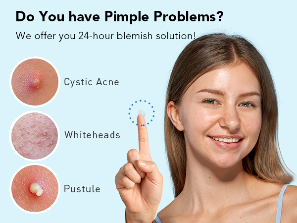 acne patches for face