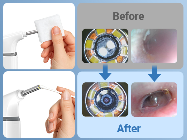 otoscope ear camera otoscope with light otoscope camera otoscope ear scope otoscope with light