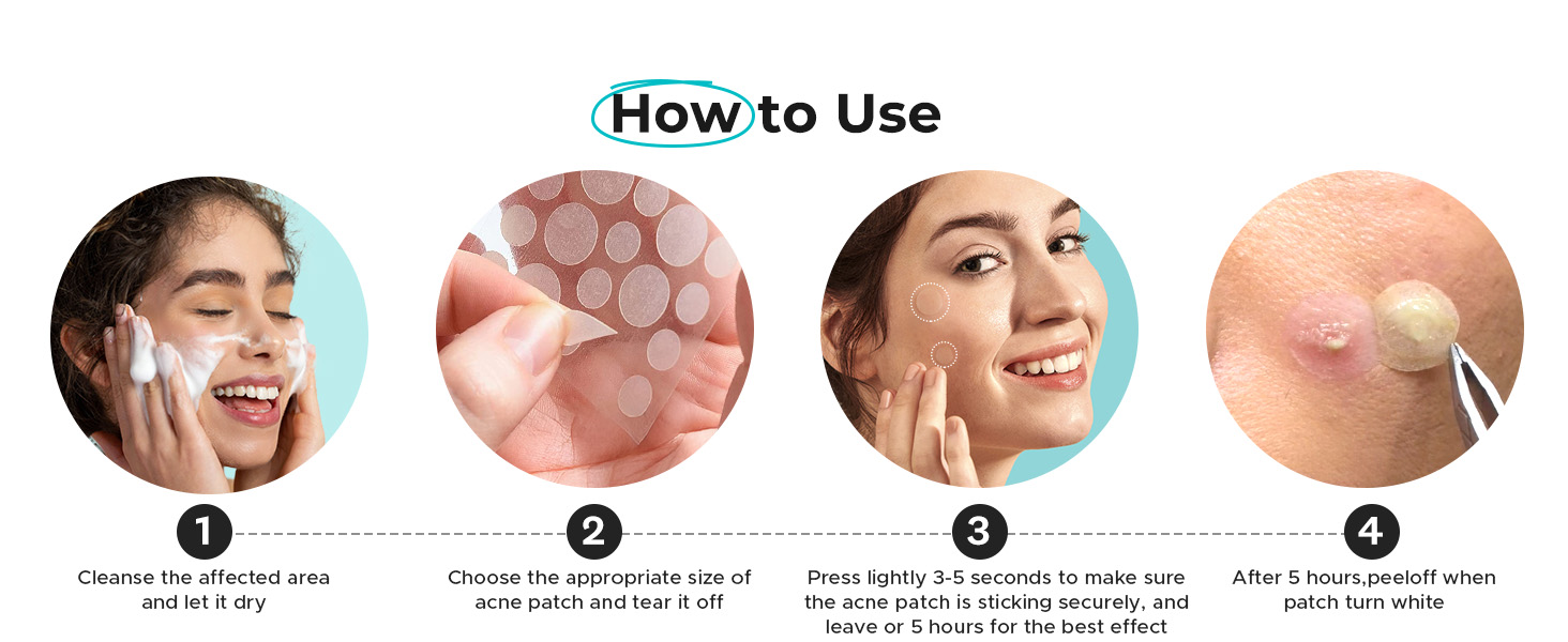 pimple patches for face