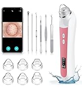 Blackhead Remover Vacuum, USB Interface Type Pore Vacuum, Black Head Extractions Tool with Camera...