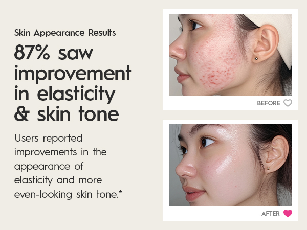 87% saw improvement in elasticity & skin tone