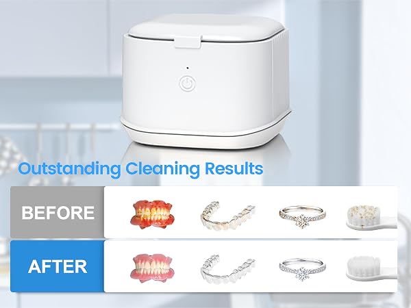 ultrasonic denture cleaner