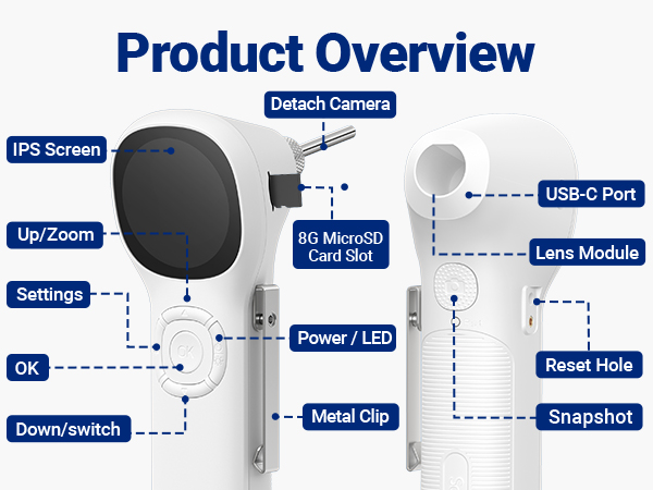 SA160 otoscope camera