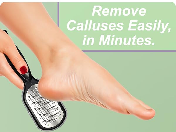 callus remover for feet