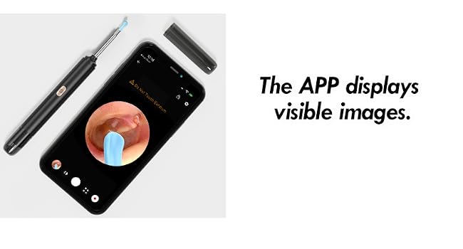 ear wax removal tool camera