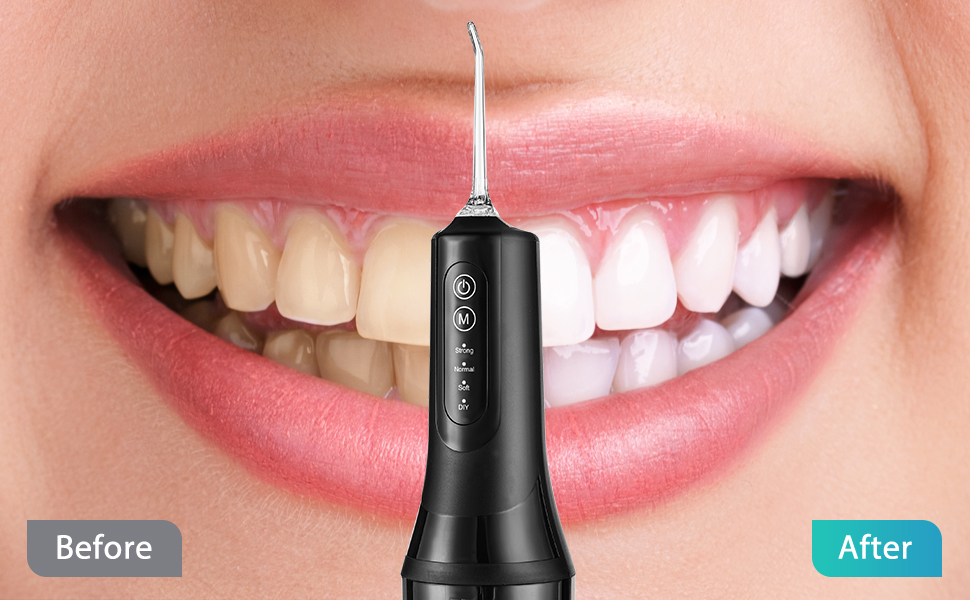 water flosser