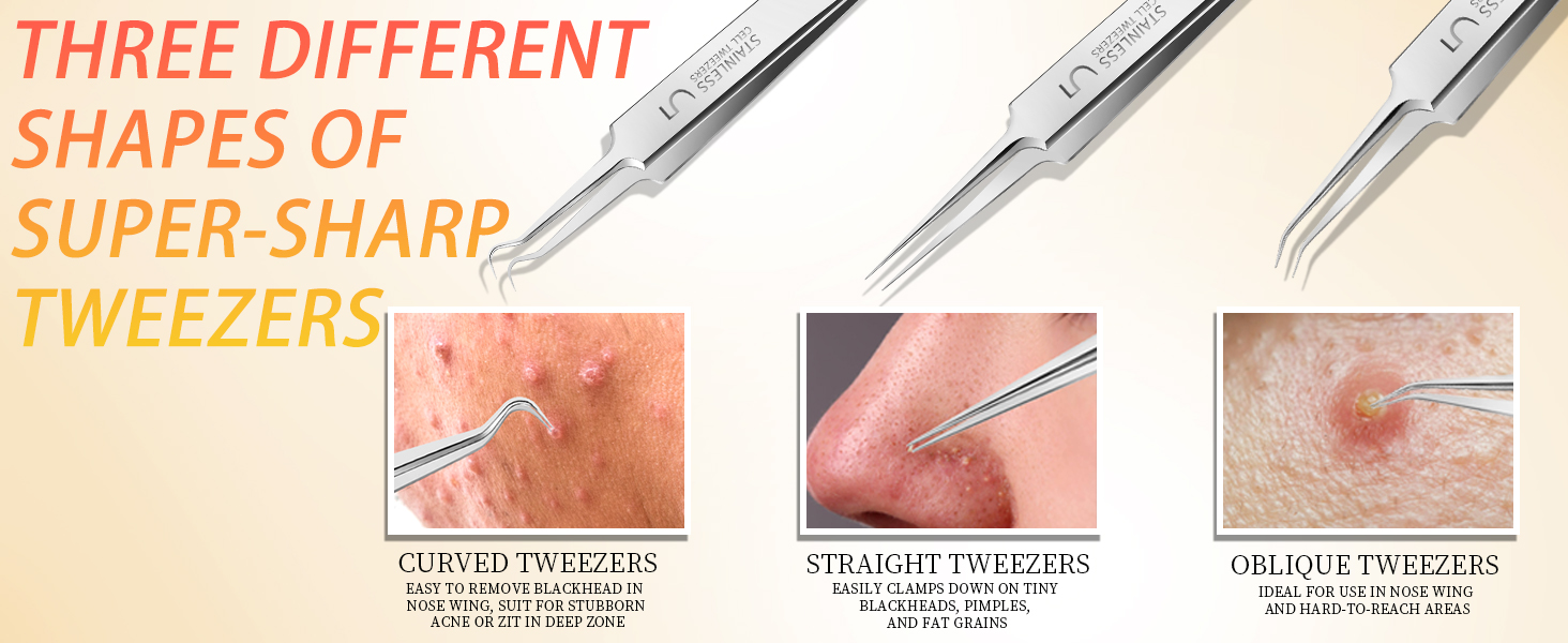 ingrown hair tweezers