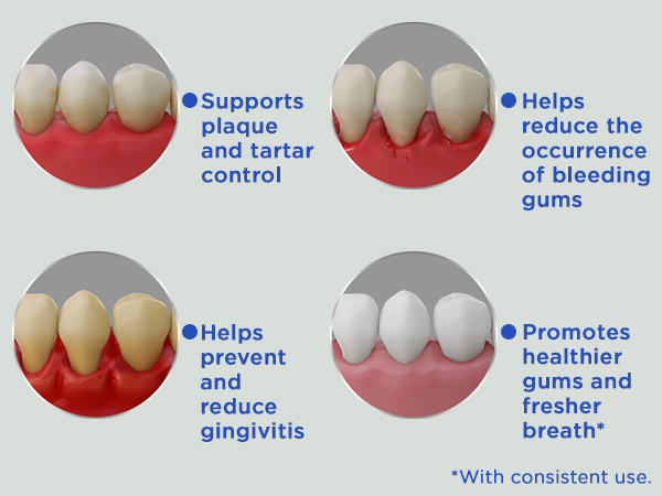 Anti-Gingivitis MW