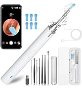 Ear Wax Removal, Ear Cleaning kit with 1296P Camera, Ear Camera with 6 LED Lights, Earwax Remover...