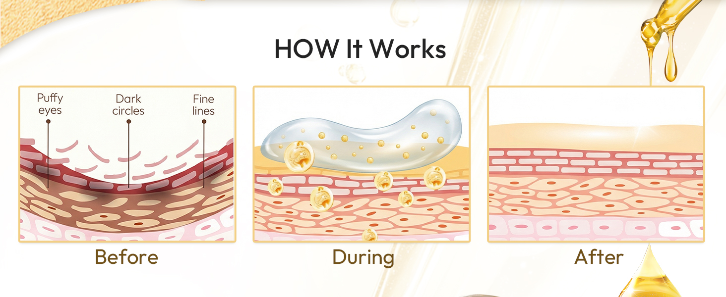 HOW It Works