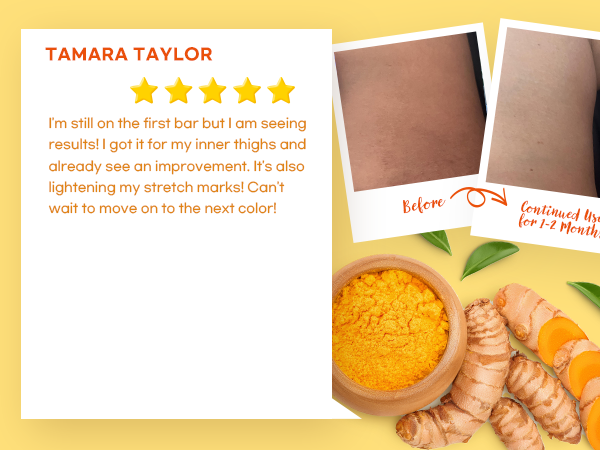 turmeric kojic acid soap