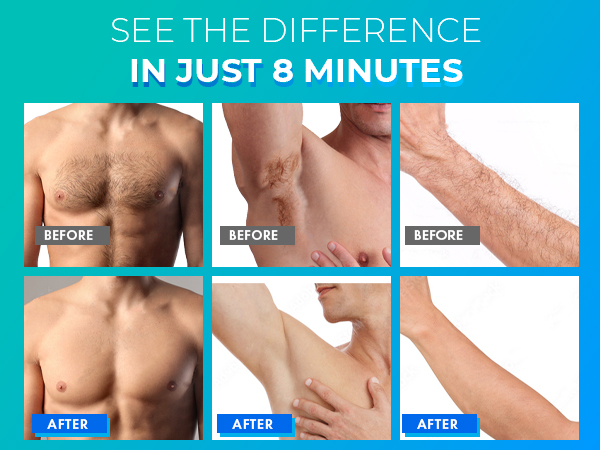 Hair Removal Cream for Men