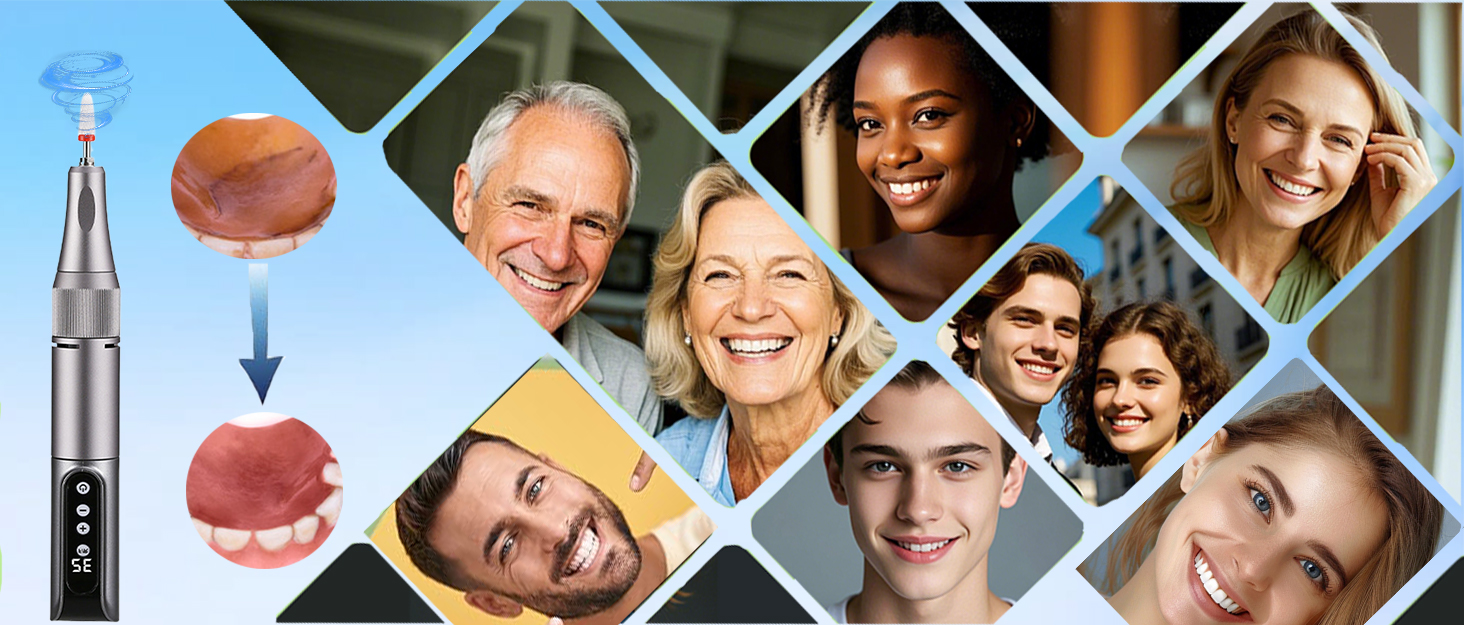 DENTURE REPAIR KIT