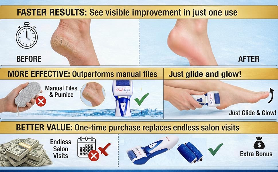 Electric Foot Callus Removers Rechargeable