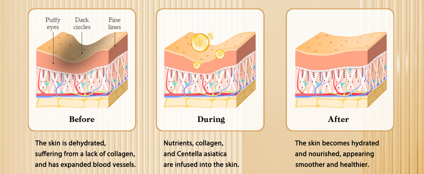 Eye Patches for Puffy Eyes