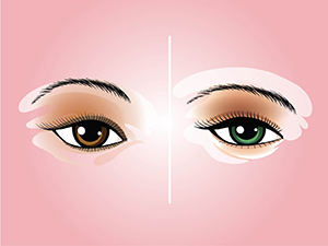 Eye Shape