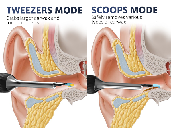 ear cleaner