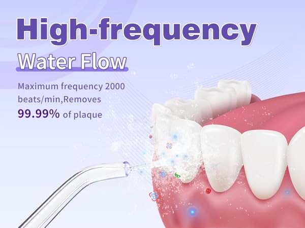 TOVENDOR Electric Water Flosser High-frequency Water Flow