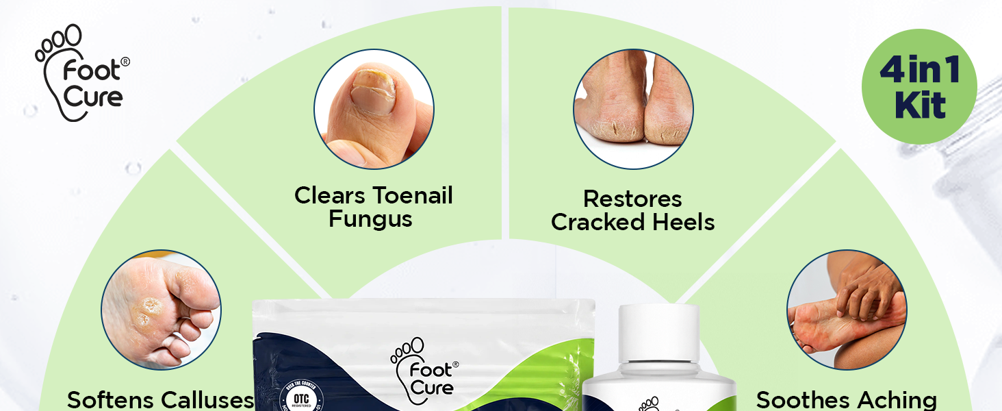 Antifungal Cream