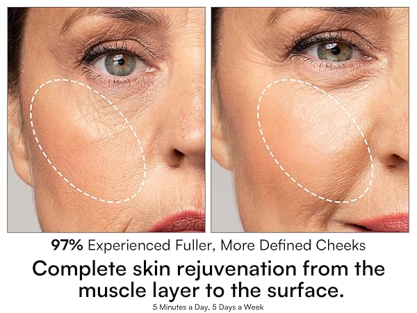 Red Light Therapy for Face