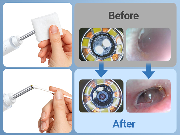 otoscope with light ear scope digital otoscope for kids smart otoscope for iphone
