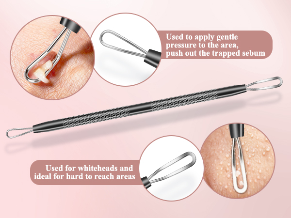 blackhead remover tools