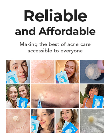 acne patches
