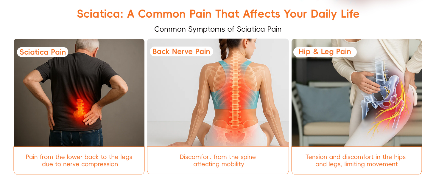 sciatica