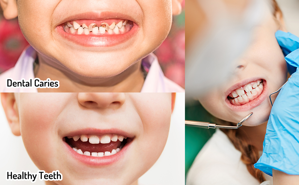 Kids Oral Spray - Toddler Toothpaste Helper