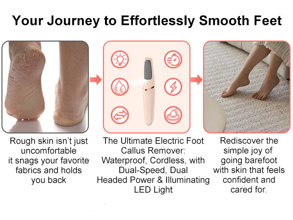 Electric Foot File