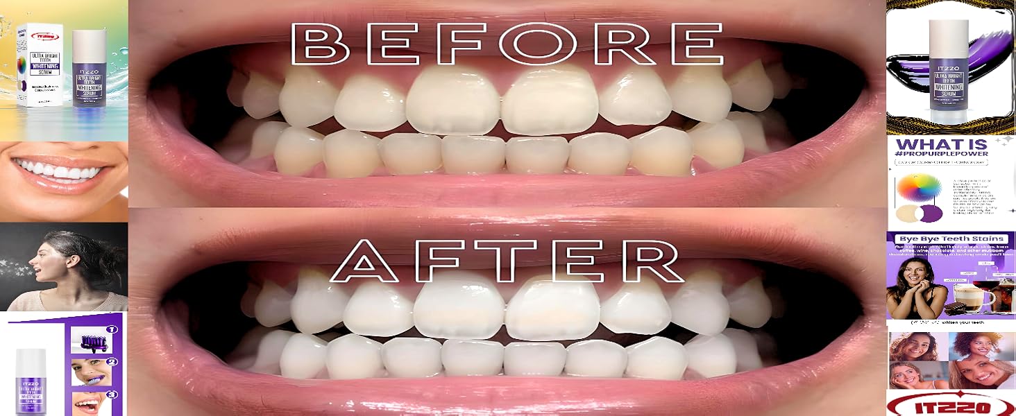 ITZZO-PurpleToothPaste-Brand