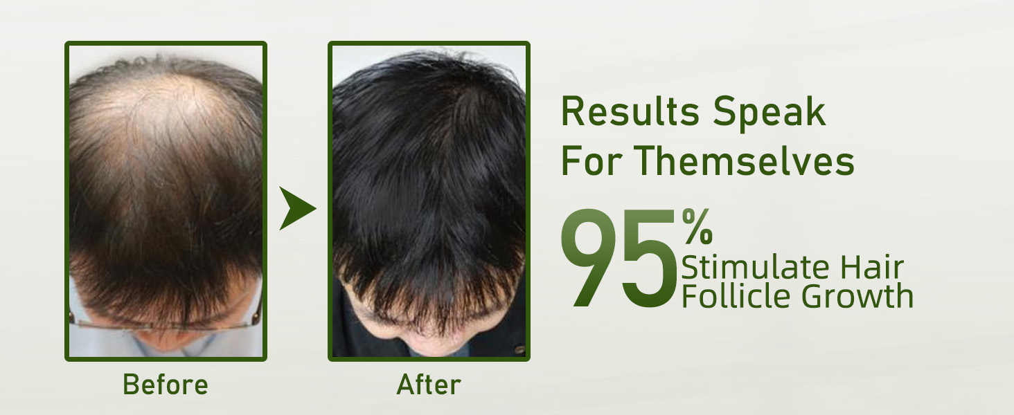 Rosemary Shampoo for Hair Growth