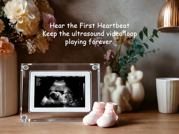 baby gift