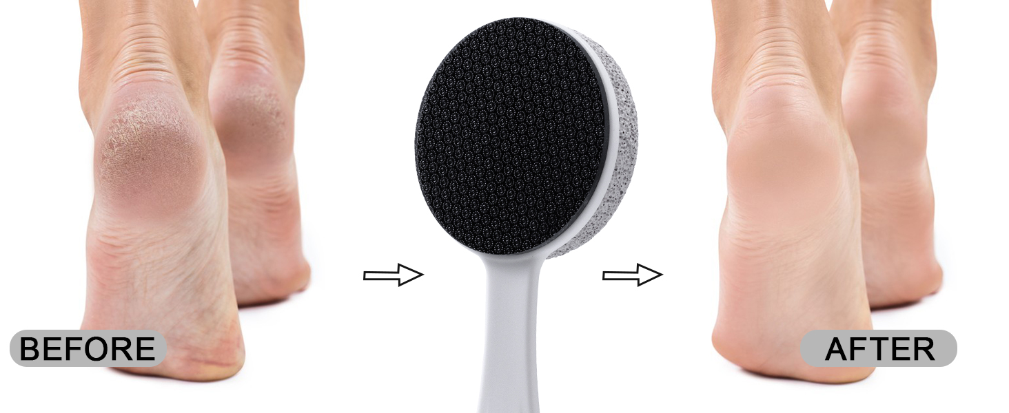 Double Sided Nano Glass and Pumice Stone for Feet Callus Remover