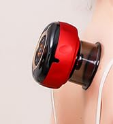 cupping set