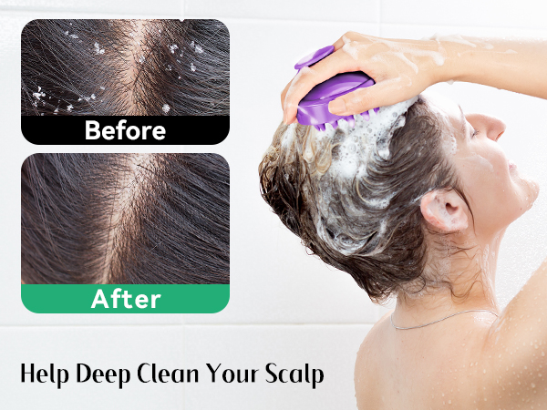 scalp scrubber