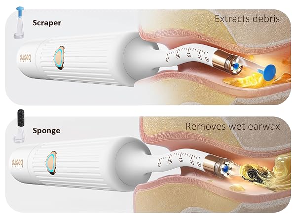 ear wax removal tool