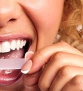whitening strips