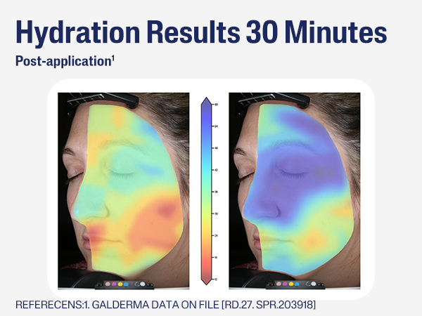 Hydration Results