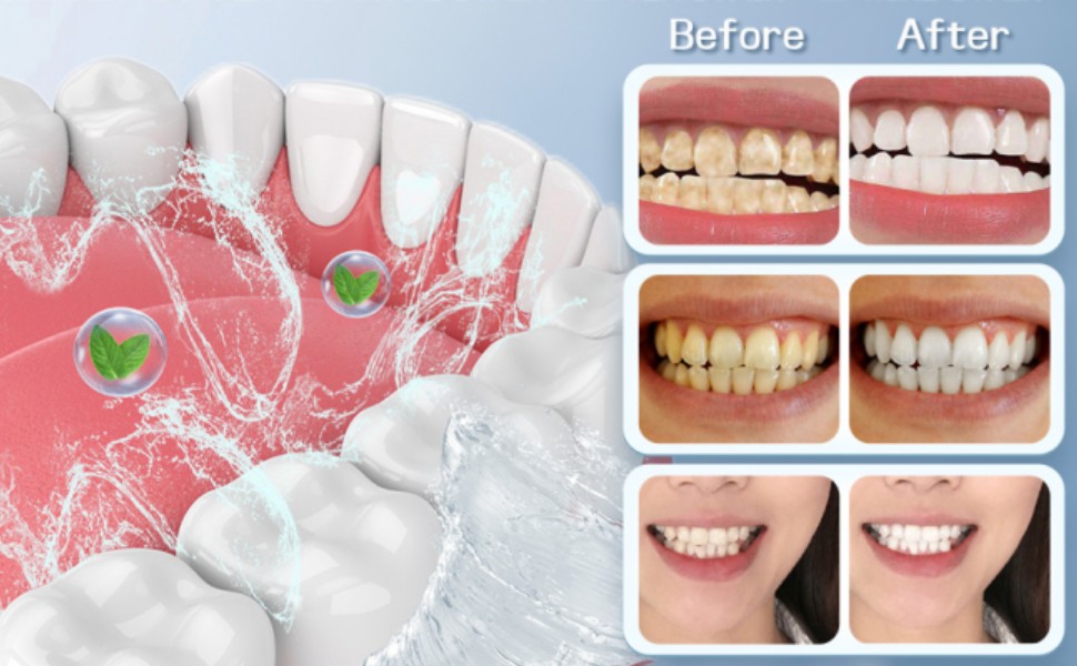 Hydroxyapatite Toothpaste