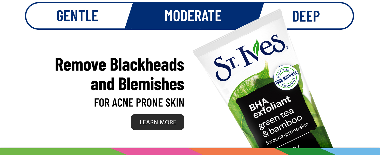 Remove Blackheads and Blemishes For Acne Prone Skin