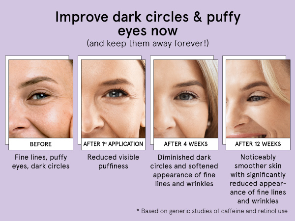 grace and stella restoring eye balm
