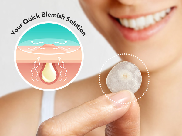 Your Quick Blemish Solution