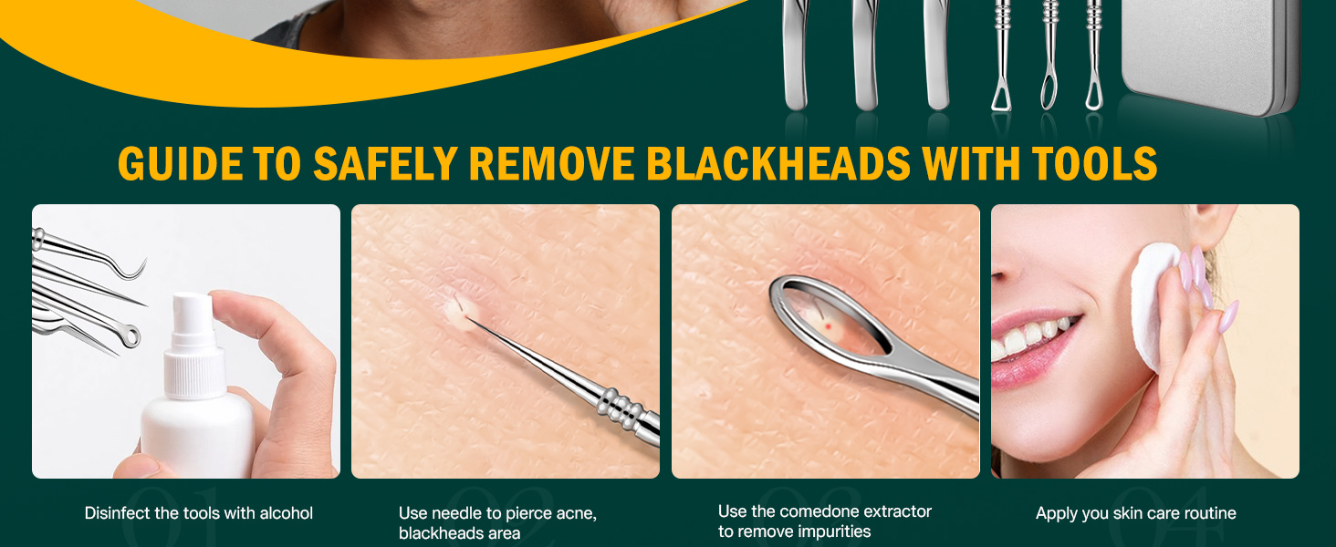 Blackhead and Acne Extractor Kit