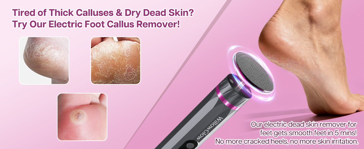 5 minutes smooth feet with WillowGlow electric callus remover,no more thick calluses,cracked heels