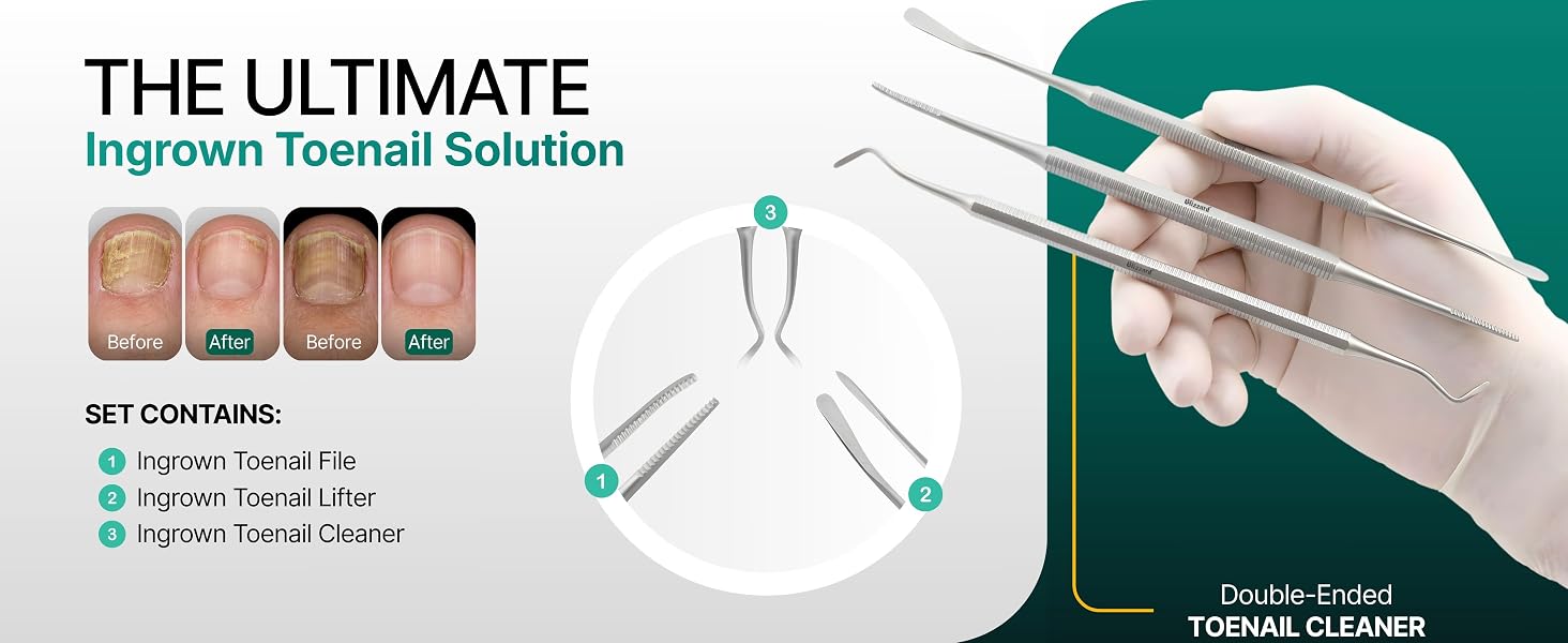 Close-up of Blizzard nail lifter tool lifting ingrown toenails and debris with precision control.