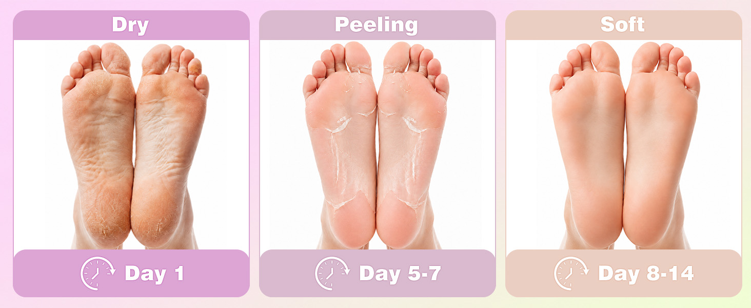 feet peeling mask